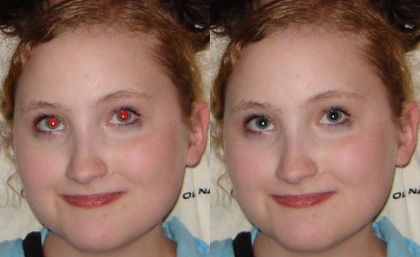 Red Eye Removal